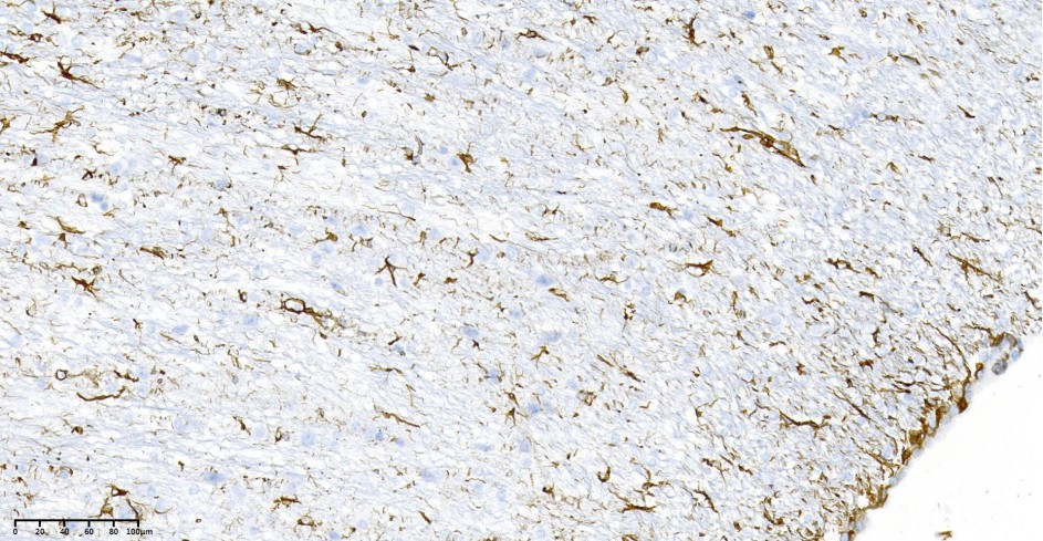 Recombinant GFAP Monoclonal Antibody - small - 4
