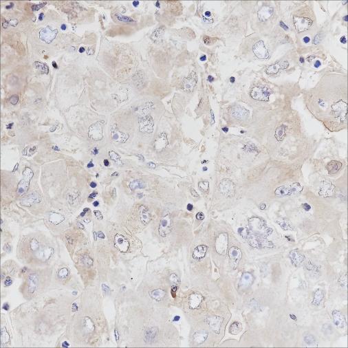 Recombinant ALDH1L1 Monoclonal Antibody - small - 2