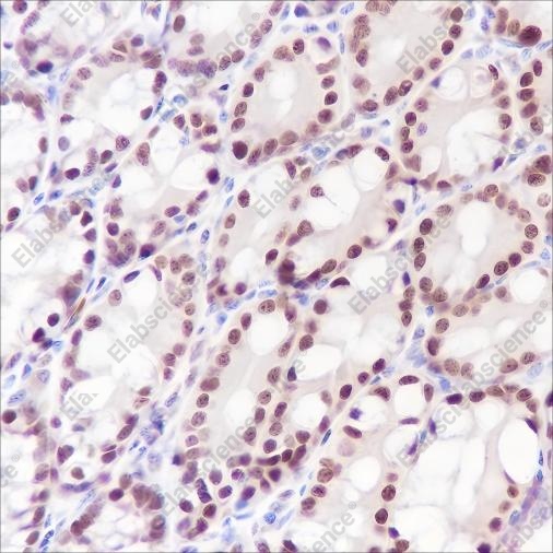 Recombinant Ku80 Monoclonal Antibody - 1