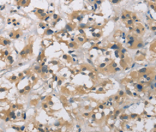 CYR61 Polyclonal Antibody - 3