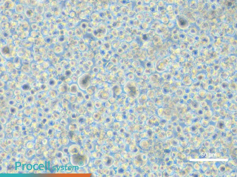 SET-2 Cell Complete Medium - 6