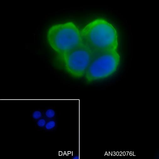 Recombinant Phospho-S6 Ribosomal Protein (Ser235, Ser236) Monoclonal Antibody - small - 4
