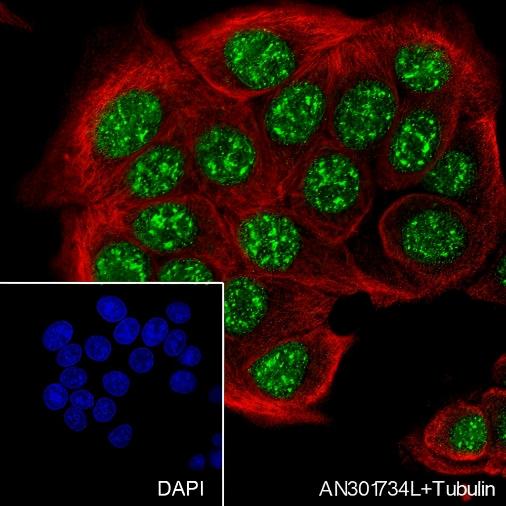 Recombinant HMGA1 Monoclonal Antibody - 2