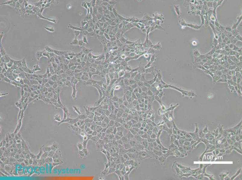 HBL-100 Cell Complete Medium - 1