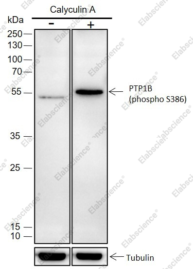 Recombinant Phospho-PTP1B (Ser386) Monoclonal Antibody - 2