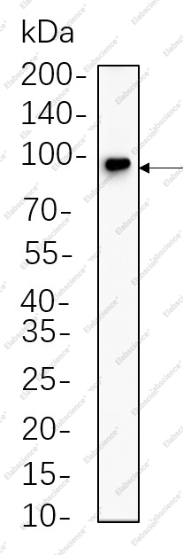 Recombinant Insulin Receptor β Monoclonal Antibody - 1