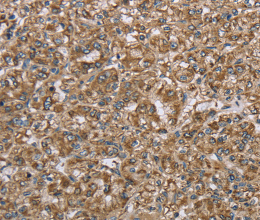 CERS4 Polyclonal Antibody - 3