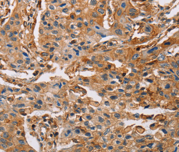 ACTA1 Polyclonal Antibody - 3