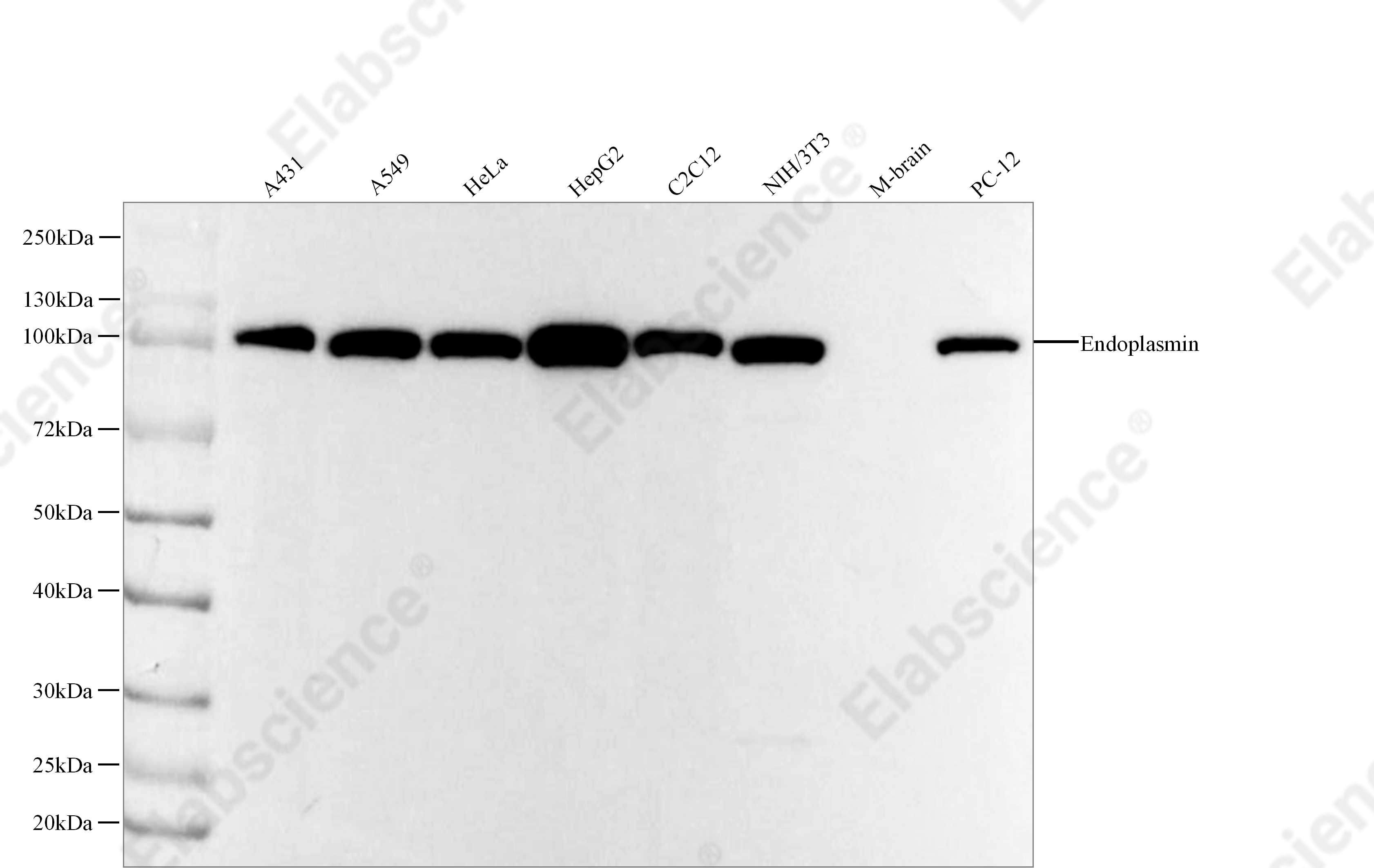 Recombinant Endoplasmin Monoclonal Antibody - 1
