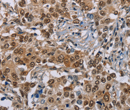 GTF2I Polyclonal Antibody - 2