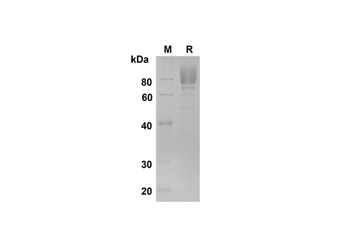 Recombinant Human CEACAM-1/CD66a Protein(Fc Tag)-产品推荐-1