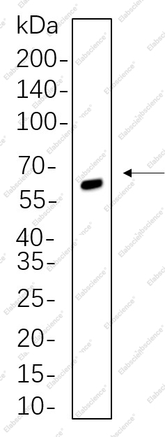 Recombinant SOX10 Monoclonal Antibody - 1