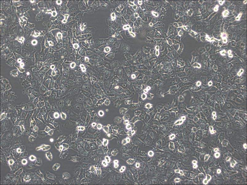 NCI-H1299 Cell Complete Medium - 3