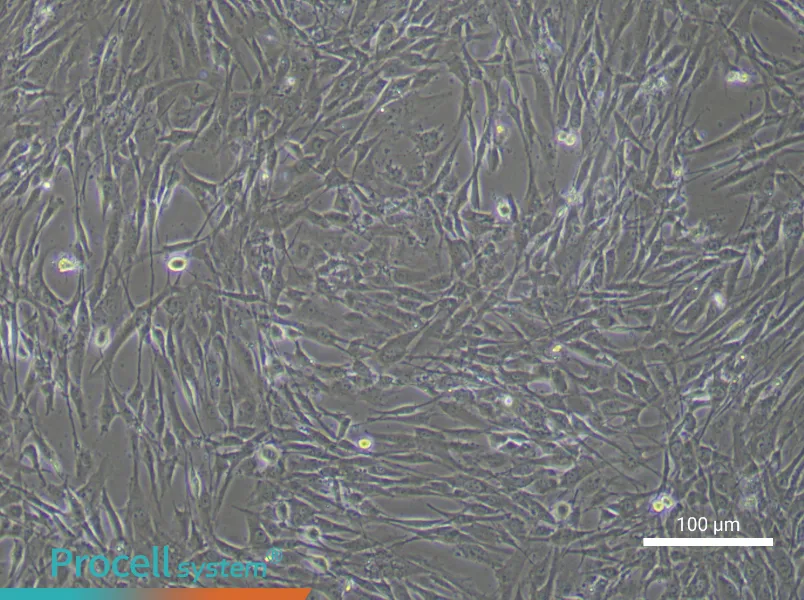 Human Bone Marrow Mesenchymal Stem (Primary cell immortalization) Cell Complete MediumHuman Bone Marrow Mesenchymal Stem (Primary cell immortalization) Cell Complete Medium - 3