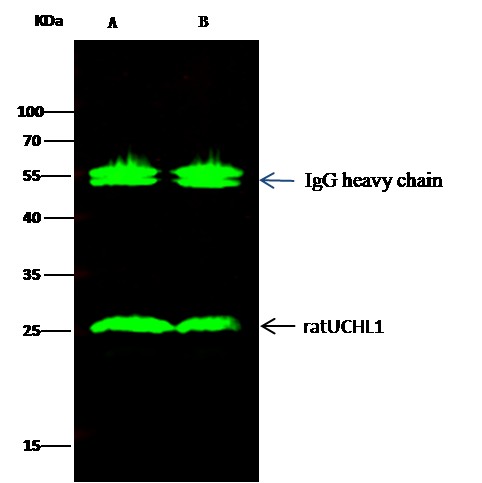Recombinant UCHL1 Monoclonal Antibody - small - 2