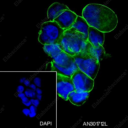 Recombinant Na+/K+ ATPase alpha-1 Monoclonal Antibody - 5