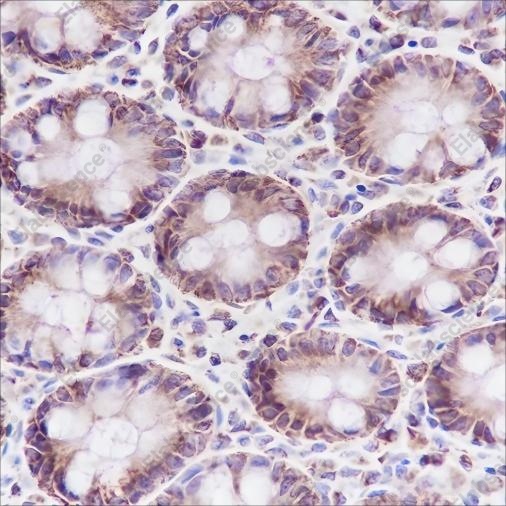 Recombinant Cpn10 Monoclonal Antibody - 2