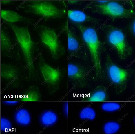 Recombinant beta II Tubulin Monoclonal Antibody - 4