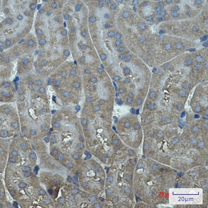 Recombinant Cytochrome P450 17A1/CYP17A1 Monoclonal Antibody - 4