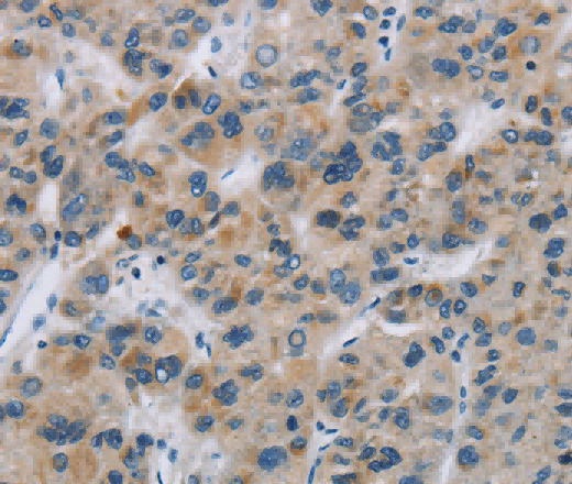 SYN2 Polyclonal Antibody - 3
