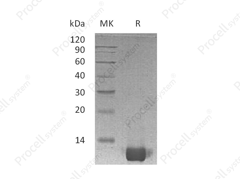 IL-8/CXCL8 (Ala23-Ser99), Human, Recombinant