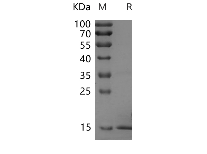 Recombinant Rat Fas/TNFRSF6/CD95 Protein(His Tag)-产品推荐-1