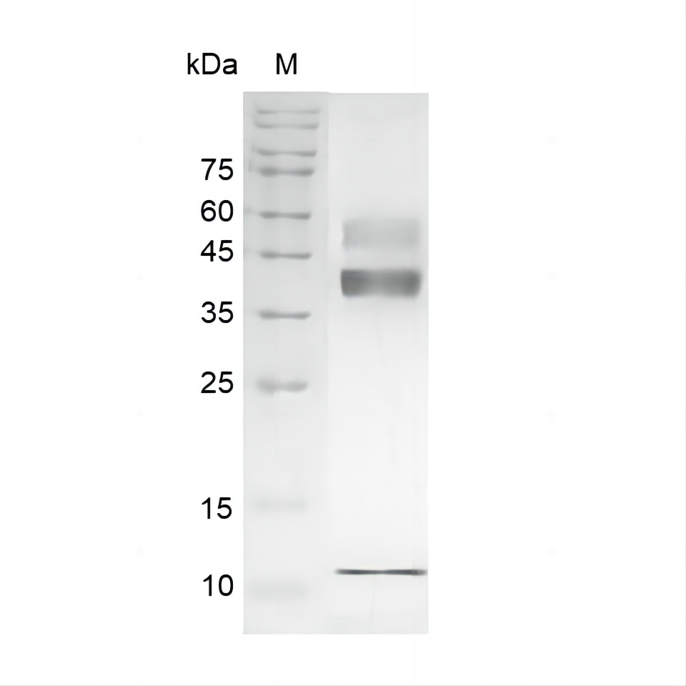 Recombinant Human TGF beta 1 protein(His Tag)-searchlist-1