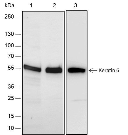 Recombinant Keratin 6 Monoclonal Antibody-searchlist-1