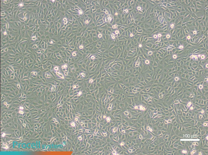 9L/lacZ Cell Complete Medium - 3