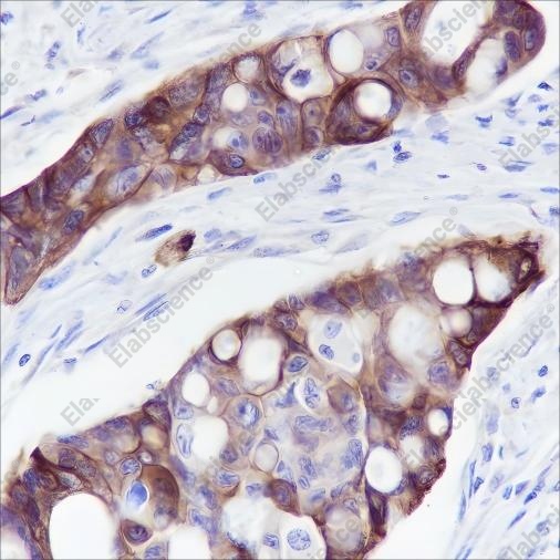 Recombinant Keratin 5/6 Monoclonal Antibody - 3