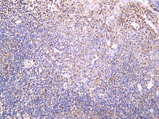 Recombinant PTP1B Monoclonal Antibody - 1