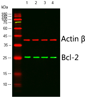 Recombinant Bcl-2 Monoclonal Antibody - 3