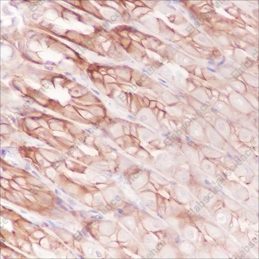 Recombinant FGFR2 Monoclonal Antibody - 3