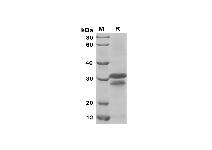 Recombinant Human CDH1 Protein(Trx Tag)-产品推荐-1