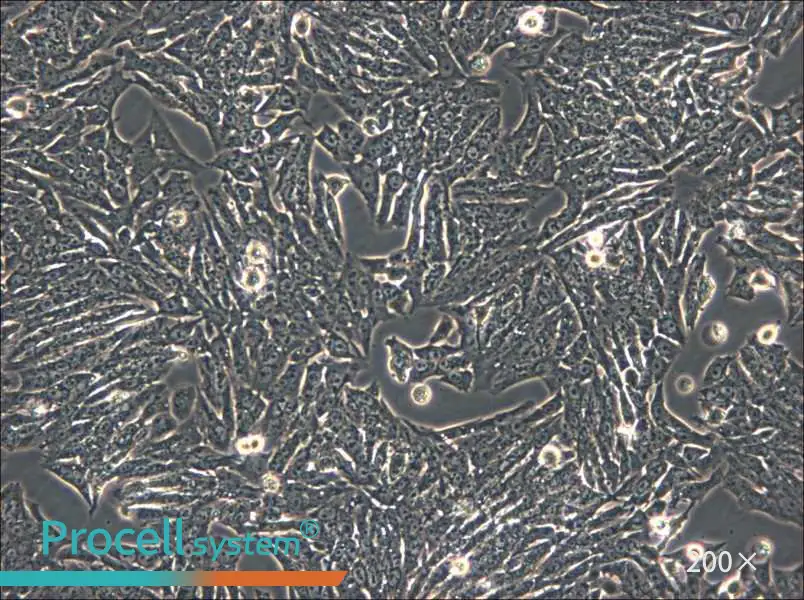 Y1 [Y-1] Cell Complete Medium - 4