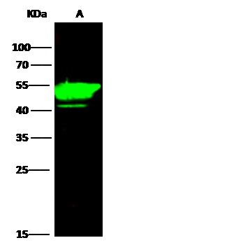 Recombinant KRT14/Cytokeratin 14 Monoclonal Antibody - small - 4