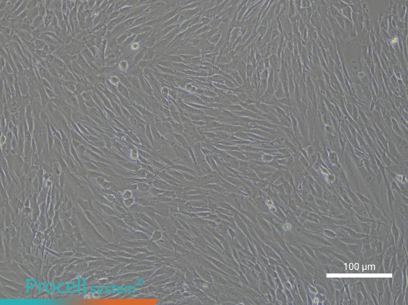 Human Aortic Smooth Muscle Cell Complete Medium - 1