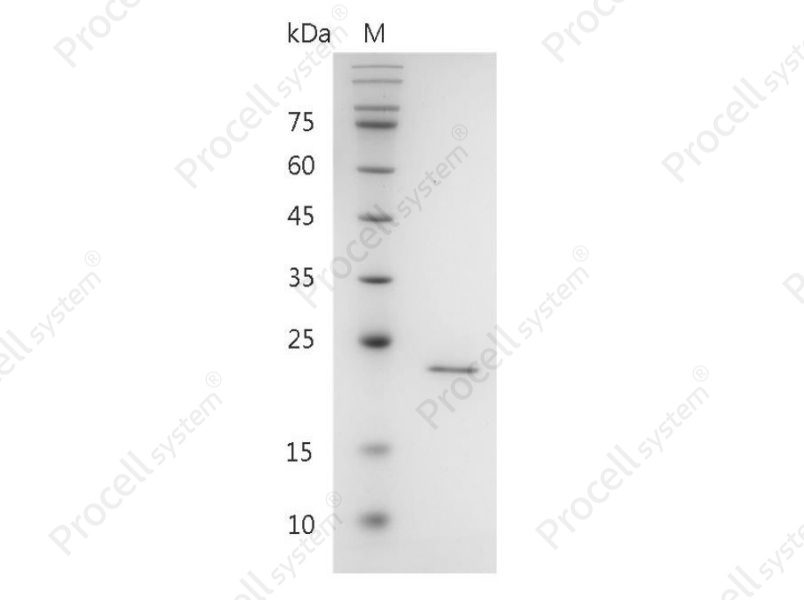 FGF-3/HBGF-3/INT2, Human, Recombinant