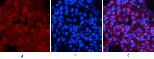 Recombinant Akt (pan) Monoclonal Antibody - small - 4