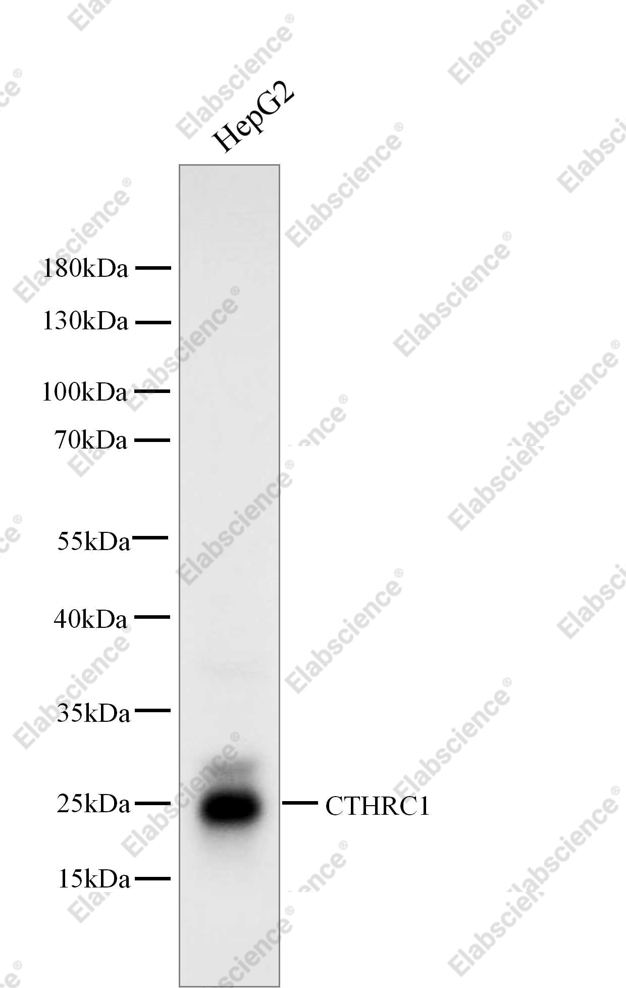 Recombinant CTHRC1 Monoclonal Antibody - 1