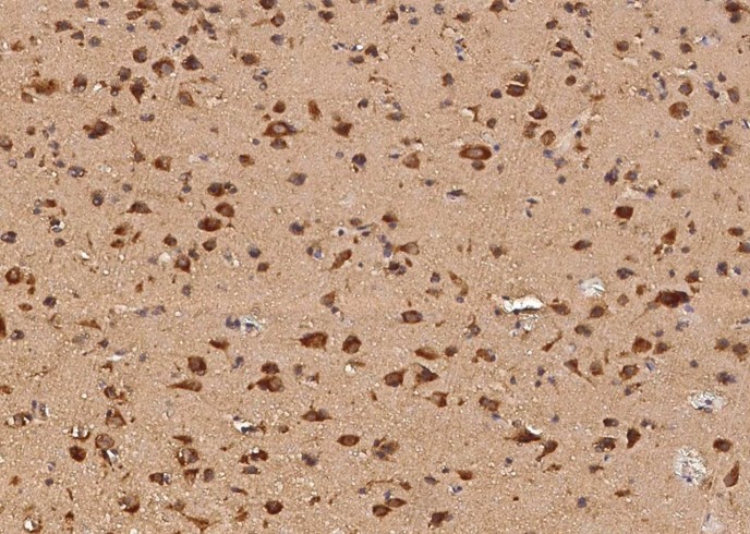 AIMP1/EMAP II Monoclonal Antibody-searchlist-1