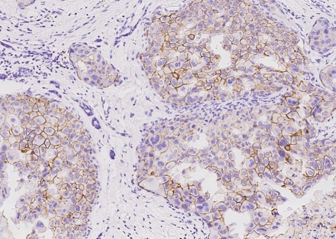 Recombinant HER2/ErbB2/CD340 Monoclonal Antibody - small - 3