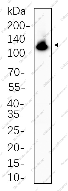 Recombinant NFkB-p100 Monoclonal Antibody - 1