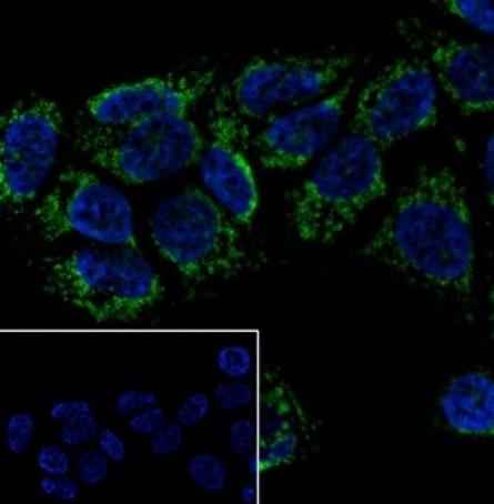 Recombinant Heme Oxygenase 1 Monoclonal Antibody - small - 7