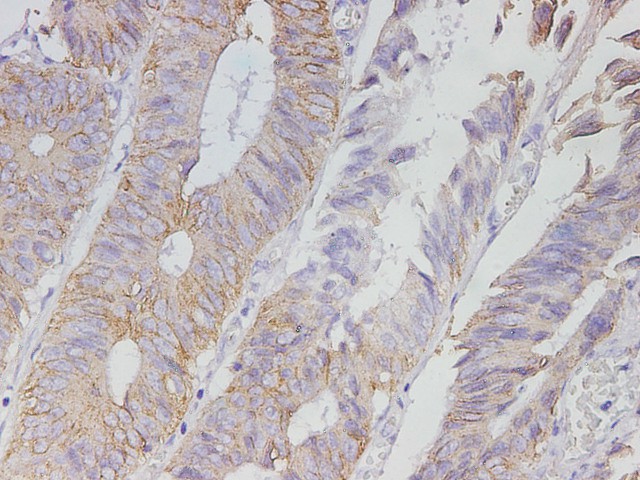 Purified Anti-Human CD138 Antibody[DL-101]-产品推荐-1