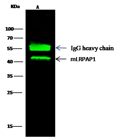 Recombinant LRPAP1 Monoclonal Antibody - small - 3