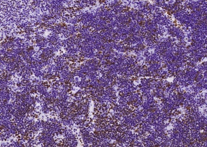 Recombinant MSH6/GTBP Monoclonal Antibody - small - 6