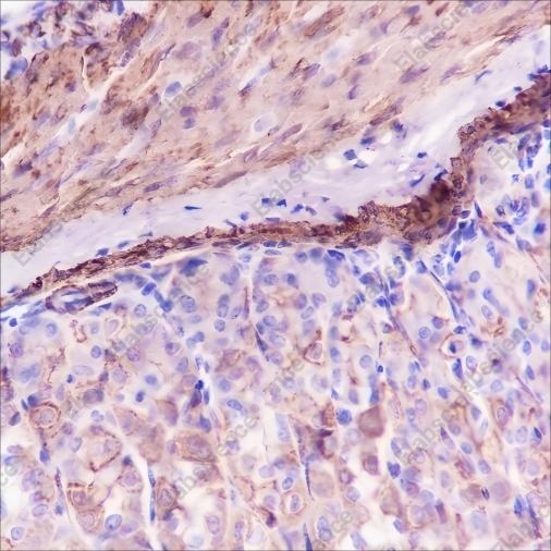 Recombinant alpha smooth muscle Actin Monoclonal Antibody - 4