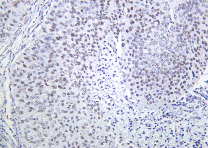 Recombinant Cdc25C Monoclonal Antibody - small - 2