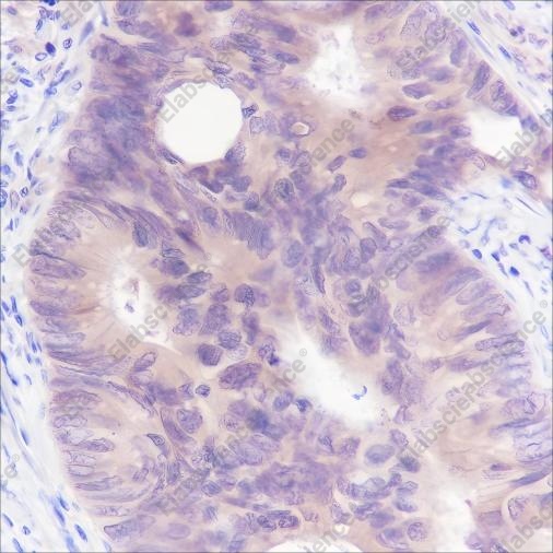 Recombinant SETBP1 Monoclonal Antibody - 1